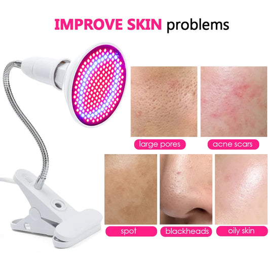 Dispositivo LED Fototerapia Viso | Luce Rossa e Blu Anti-Acne Anti-Rughe | CE