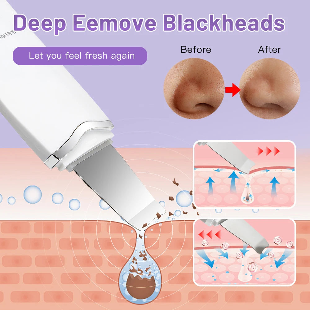 Elettrico Ad Ultrasuoni Scrubber Della Pelle Vibrazione Viso Spatola Peeling Rimozione di Comedone Lifting Del Viso Pulizia Ad Ultrasuoni Cura Della Pelle