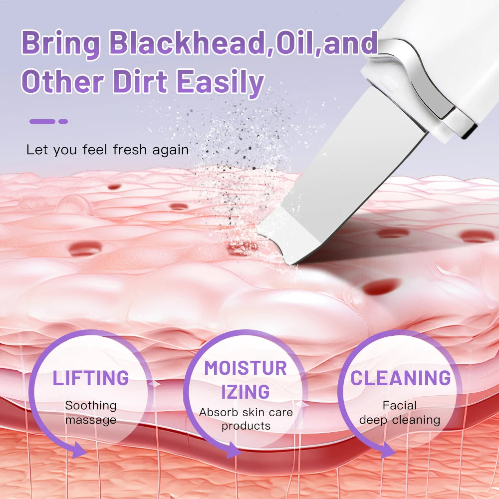 Elettrico Ad Ultrasuoni Scrubber Della Pelle Vibrazione Viso Spatola Peeling Rimozione di Comedone Lifting Del Viso Pulizia Ad Ultrasuoni Cura Della Pelle
