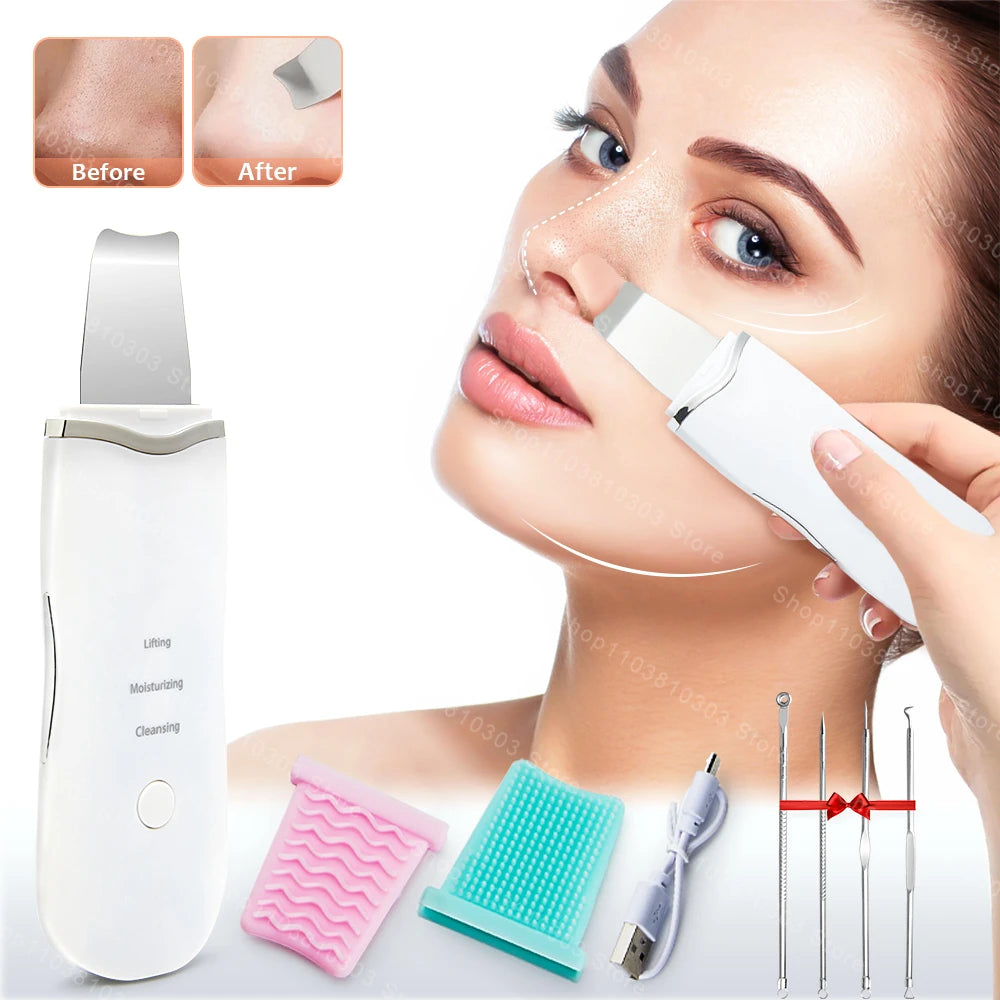 Elettrico Ad Ultrasuoni Scrubber Della Pelle Vibrazione Viso Spatola Peeling Rimozione di Comedone Lifting Del Viso Pulizia Ad Ultrasuoni Cura Della Pelle