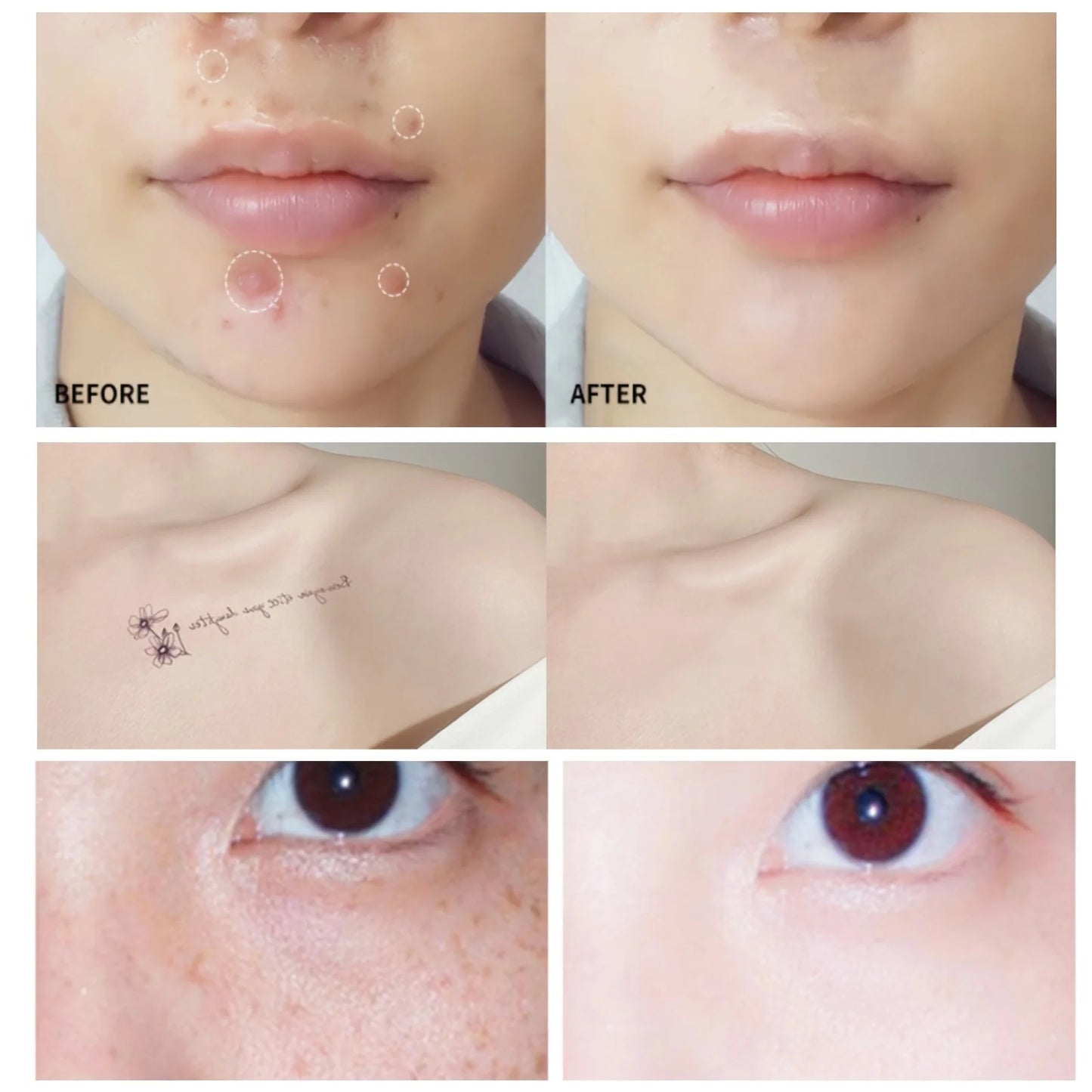 Correttore in Crema Impermeabile – Lunga Durata, Copre Acne, Macchie e Occhiaie