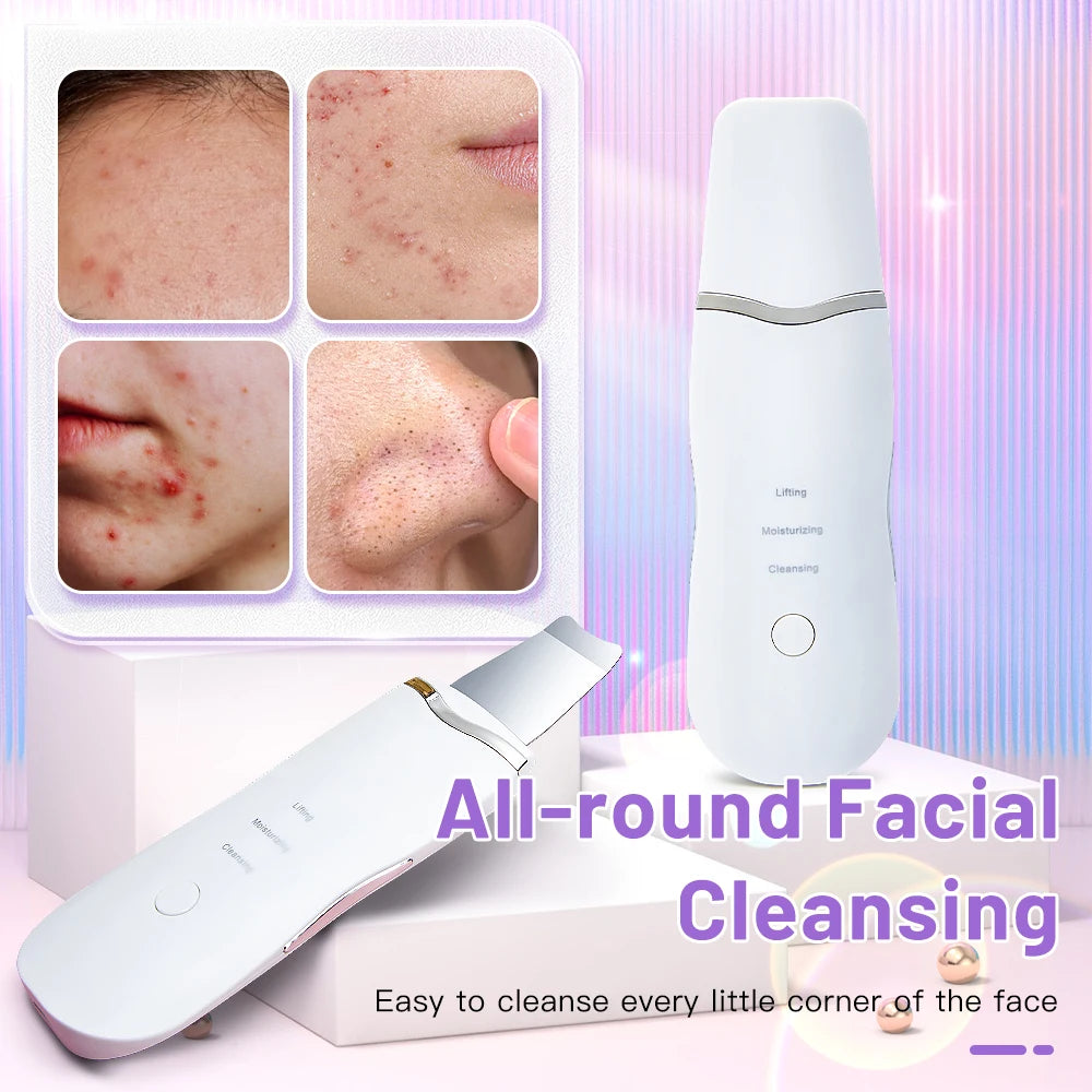 Elettrico Ad Ultrasuoni Scrubber Della Pelle Vibrazione Viso Spatola Peeling Rimozione di Comedone Lifting Del Viso Pulizia Ad Ultrasuoni Cura Della Pelle